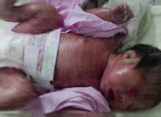 46岁想做试管婴儿生三胎成功率多少？附成功经验分享