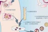 2026年三代试管婴儿私立医院的技术安全吗？必看！