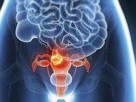 移植后经常做春梦发生宫缩是因为子宫排斥胚胎吗？