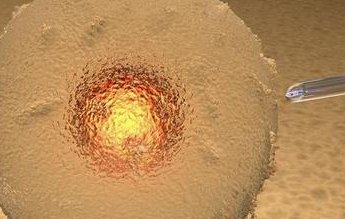 2026中山试管婴儿医院排名，附详细医院名单!