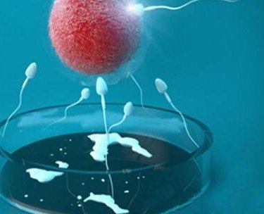 女性有染色体罗氏易位在林州市做试管养囊成功率高吗？试管移植后需要保胎吗！